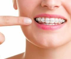 THE BENEFITS OF GETTING INVISALIGN TREATMENT FROM A LEADING PROVIDER IN THANE