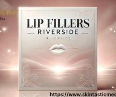 Enhance Your Beauty with Lip Fillers in Riverside