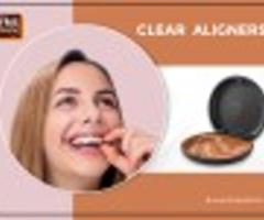 Clear Aligners Treatment in Hyderabad, India -kochi