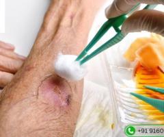 Diabetic Wound Care Specialist | Dr. Rahul Agarwal