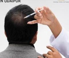 Hair Transplant Aftercare and Recovery at Dermadent Clinic