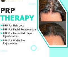 Best PRP Treatment in Mohali 3B2 at Esthetica Cosmetology