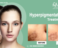 Transform Your Confidence – Hyperpigmentation Treatment at Anew