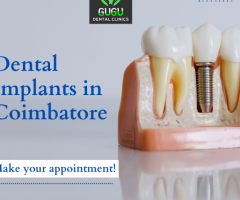 Dental implant in Coimbatore - Gugu Dental Clinic