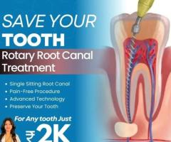 Best Root Canal Treatment in Nellore | Just 2k per Tooth - 1