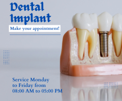 What are Dental Implants ?