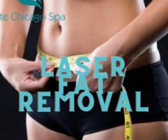 Laser Fat Removal Chicago
