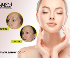 Rejuvenate your face with the best face lift surgery in Bangalore