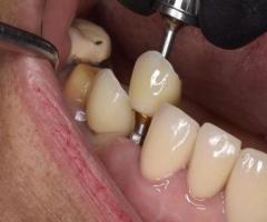 Revive your natural and flawless smiles with holistic Dental care in Tijuana