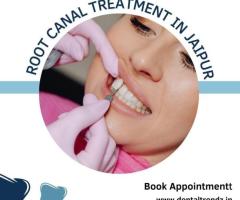 Root Canal Treatment in Jaipur