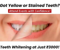 Overcome Teeth Discoloration with Zoom Teeth Whitening in Nellore – Fast, Effective, and Safe