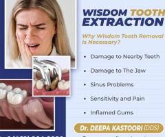 Wisdom Teeth Removal in Dallas