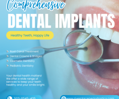 What is dental implants placement ? Are dental implants safe ?