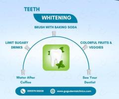 Teeth Whitening Tips- Gugu Dental clinic, Coimbatore