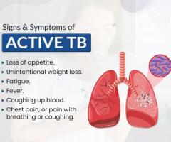 Which hospital offers pulmonary lung function test in Hyderabad