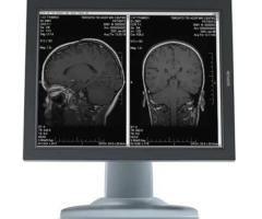 Hiliex High-Resolution Medical Diagnostic Displays for Precision Care