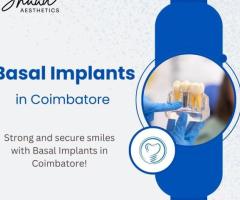 Basal Implants in Coimbatore | Shaadaesthetics