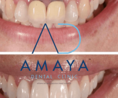 Best dental clinic in Bangalore