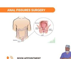 Best Anal Fissure Treatment in Delhi : Habilite Clinics