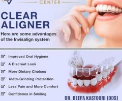 Clear Aligners in Dallas