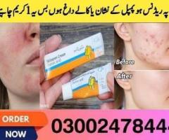 Skinoren Cream In Pakistan - 03002478444