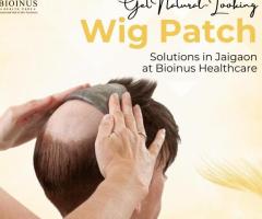 Get Natural-Looking Wig Patch Solutions in Jaigaon at Bioinus Healthcare