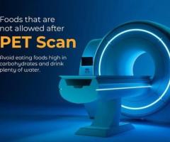 Best & Affordable CT Scan Lab Test in Delhi | Easy Book My Lab