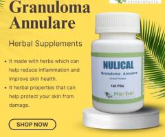 NULICAL: Granuloma Annulare Herbal Supplement