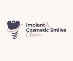 Implant and Cosmetic Smiles