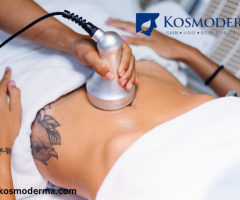 Fat Freezing & CoolSculpting Treatment in Delhi | Non-Surgical Body Contouring at Kosmoderma