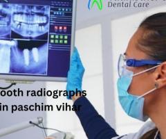 Tooth Radiographs in Paschim Vihar – Accurate Dental Diagnostics at Yudhisther's Dental Care