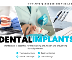 Are Dental Implants Safe or not ?