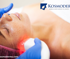 Melasma Treatment in Bangalore | Best Dermatologists in Indiranagar at Kosmoderma