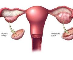 Top Fertility Hospitals Best IVF Doctors in Bangalore Best Fertility Hospitals in Bangalore