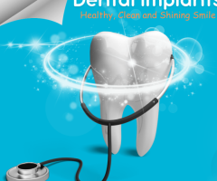 What are dental implants procedures ?