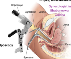 Best Gynecologist Surgeon for Myomectomy Doctor in Bhubaneswar