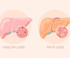 Restoring Liver Health Naturally with Homeopathic Remedies