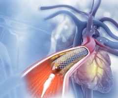 Do Stents and Bypass Surgery Cure Heart Disease? The Shocking Truth