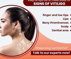 best laser treatment clinic in india