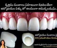 Zirconia Teeth Implants in Nellore – Natural Smile Guaranteed!