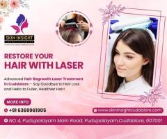 Hair Regrowth Laser Treatment in Cuddalore