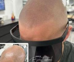 Scalp Micropigmentation in UK London