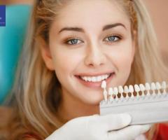 Teeth Whitening Cost in NJ | Affordable & Professional Services