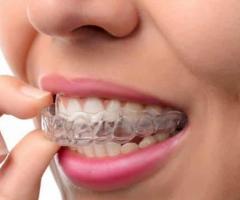 Invisible Teeth Aligners Cost