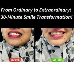 A New Smile, A New You – Book Your Smile Makeover Today!