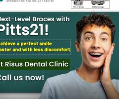 Best Braces in Nagaram & ECIL | Pitts21 Braces & Orthodontic Care in AS Rao Nagar