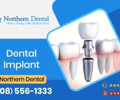 Say Goodbye to Missing Teeth with Advanced Dental Implants