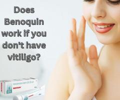 Best Skincare cream Benoquin Cream| Release dark patches form your skin use Benoquin Cream