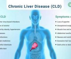 Stem Cell Therapy For Liver Damage