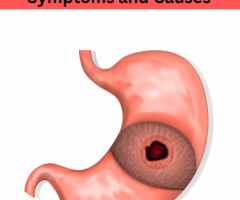 The Symptoms and Causes of Gastrointestinal Bleeding